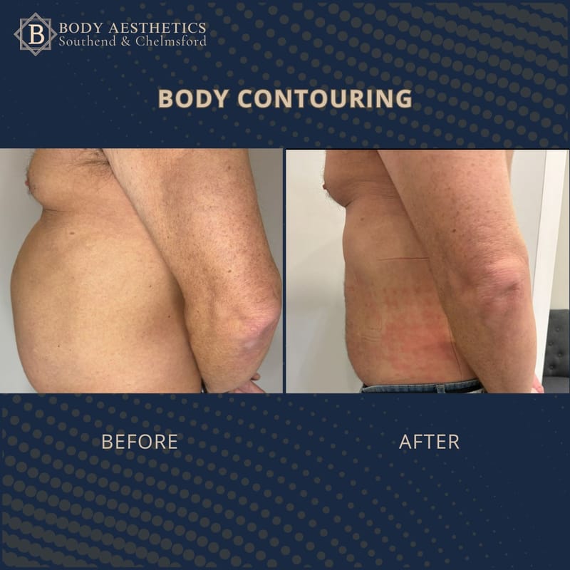 Laser Clinic Southend - Body Aesthetics
